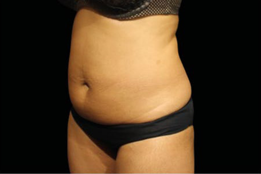 womans waist