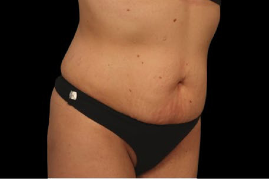 womans waist