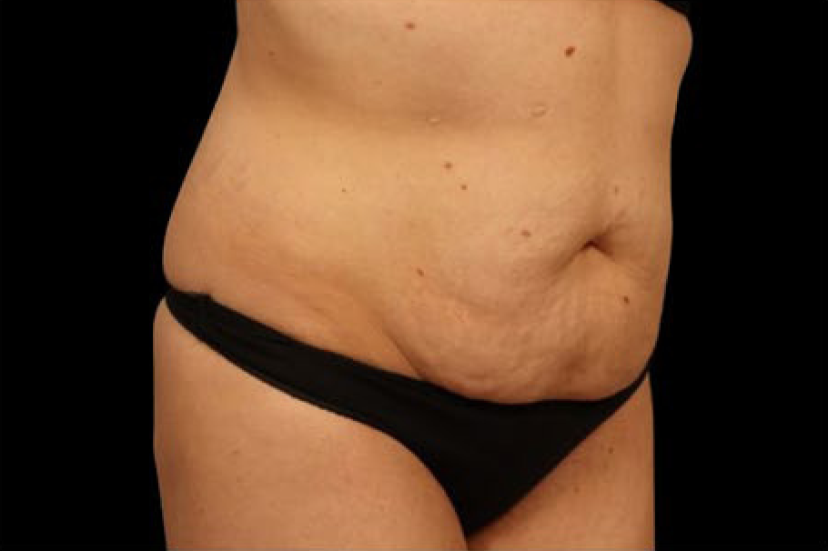 womans waist