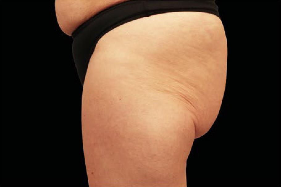 womans butt