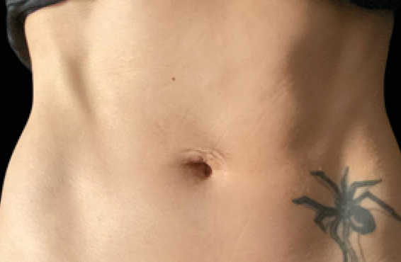 female stomach
