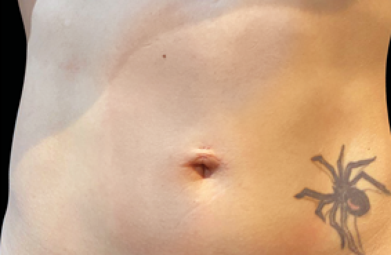 female stomach