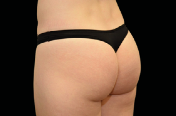 female butt