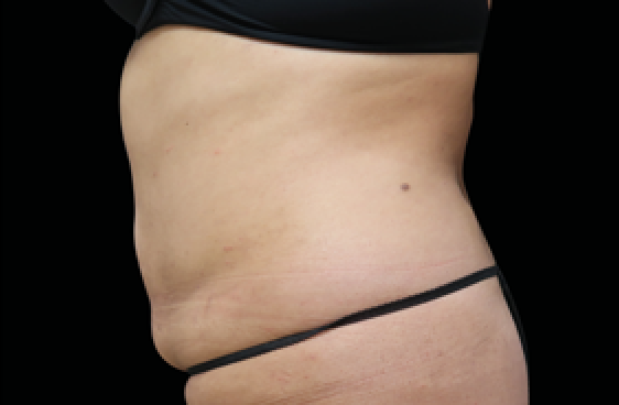 female belly