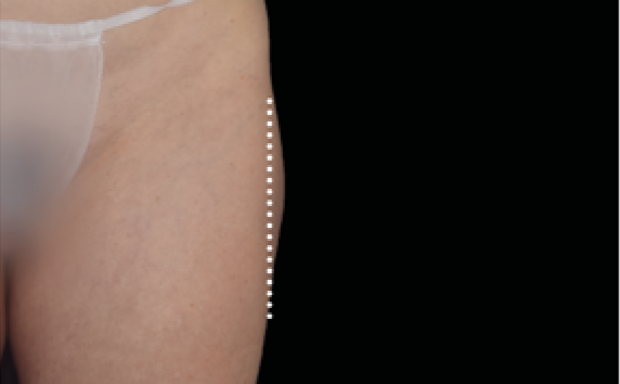 female thighs
