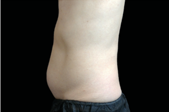 Man stomach