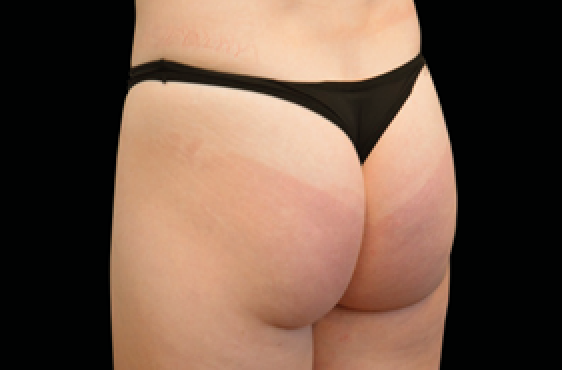 female butt