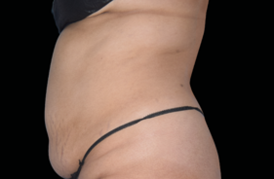 female belly