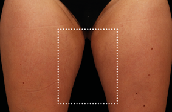 female thighs