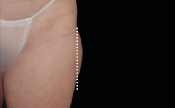 female thighs