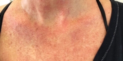 womans chest