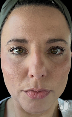womans face