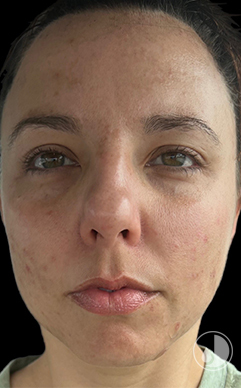 womans face