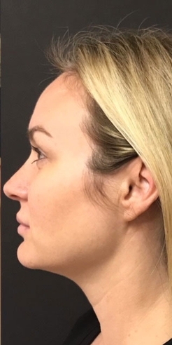 womans face
