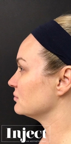 womans face