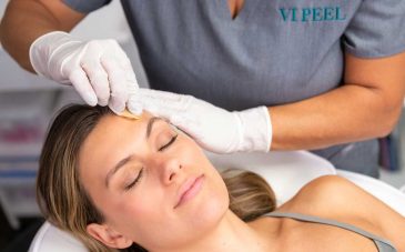 VI Peel procedure